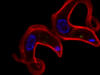 Trypanosoma © Jean-Mathieu Bart, IRD